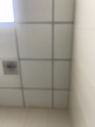 -蚌埠国色医疗美容医院•眼鼻整形