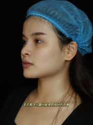 -广东韩妃整形外科医院