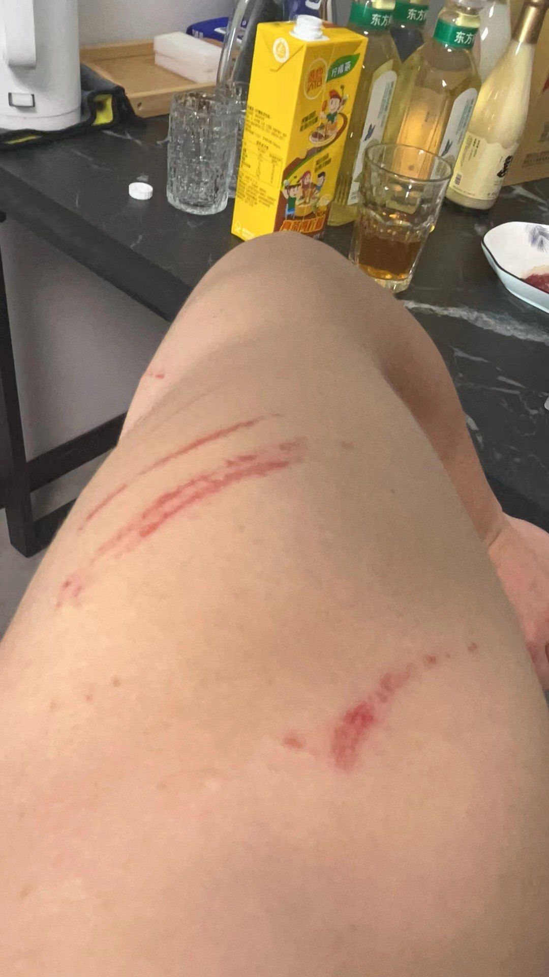 🧨期间打架是什么感觉?