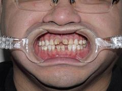 -和平卓尔口腔·矫正种植中心
