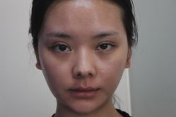 -成都西区医院整形美容