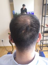 -极客侠男士假发定制补发