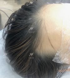 -西施无菌半永久纹绣眉眼影唇轻增发纹发际线
