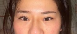 体验后-天津伊美尔医疗整形美容专科医院