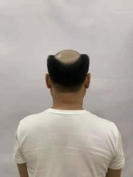 -唐风采假发补发定制