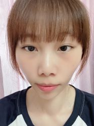 体验后-坤如玛丽·医疗美容中心