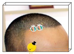 -大麦微针植发全国连锁