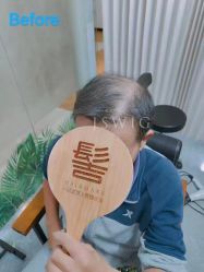 -髻尚坊增发补发织发假发定制