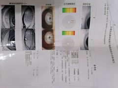 -大连何氏眼科医院