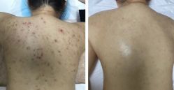 -康美贞·痘肌养护管理中心