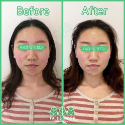 -FACE·日本小颜矫正美容整骨サロン