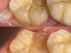 -同步齿科·数字化正畸种植口腔中心(前山店)
