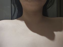 体验前-上海伊莱美医疗美容医院