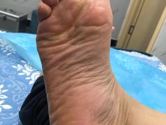 -杨一刀修脚(马连道南街店)