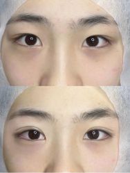 -脸博士医疗美容·眼鼻整形·抗衰中心