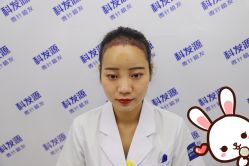 点击看大图 -大麦微针植发丨全国连锁