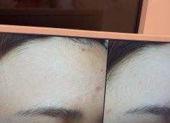 -苑苑vbeauty科技美容SPA