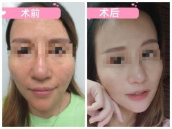 -素美医疗美容·西南眼鼻整形·修复基地