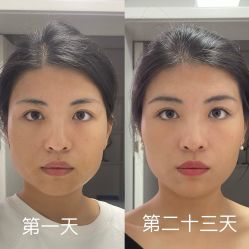 -成都西区医院整形美容
