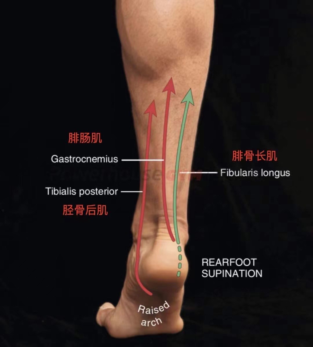 腓骨长肌痛图片