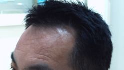 -雍禾植发全国连锁