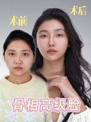 -Yestar重庆艺星医疗美容医院