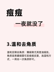 -克丽缇娜