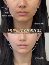 -上海华美医疗美容医院