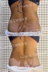 -Fundi张玉珊修身堂·indiba·BTL科技瘦身