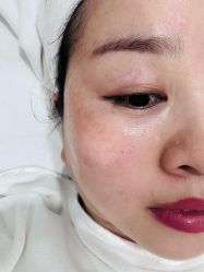 -黎蓓露·徒手骨雕蛋白抗衰·调肤管理