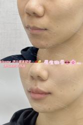 -深圳艺星医疗美容医院