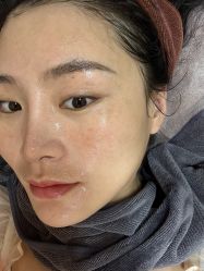 体验后-深圳广和门诊部·整形医疗美容