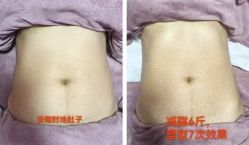 -Lily纤美·科技减脂中心