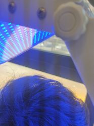 -碧莲盛·不剃发植发