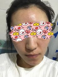 体验后-繁星轻医美连锁