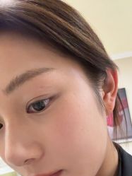 -长沙雅美医疗美容医院