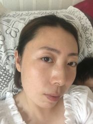 体验后-北京京通医院医疗美容
