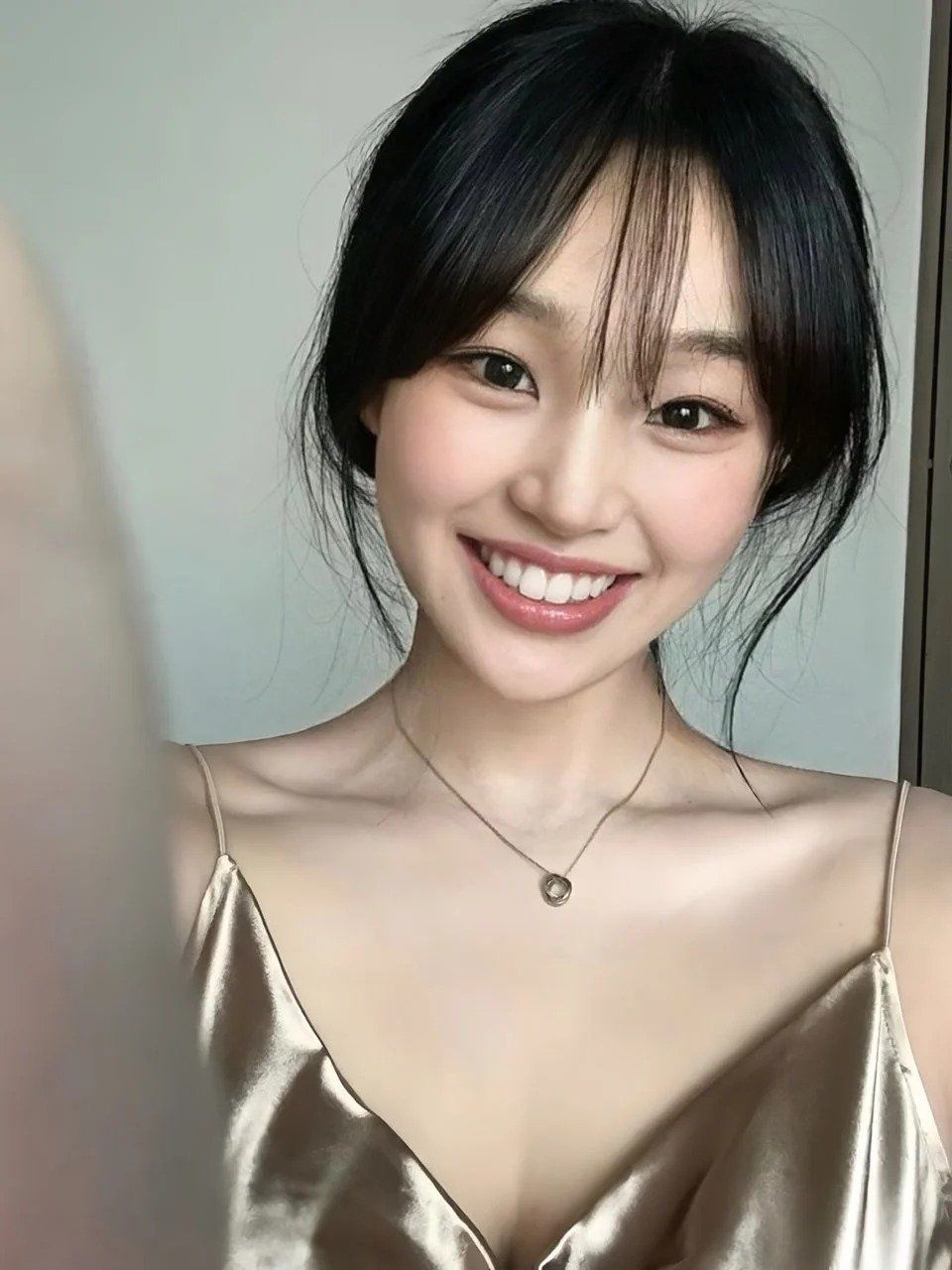 看牙plog丨困扰很久的龅牙问题终于