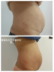 -骄阳兰多产后恢复&减龄中心(万科金域东郡店)