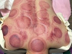 -沈师傅盲人按摩工作室(密三小区店)