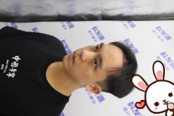 -大麦微针植发丨全国连锁