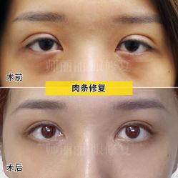 -丰联丽格医疗美容·联合丽格眼整形中心