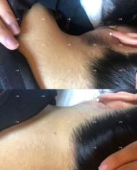 -小梨·OndaPro·专业脱毛连锁机构
