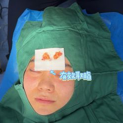 -广州健丽·去眼袋医疗美容机构