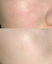 -苗方清颜痘肌研究所