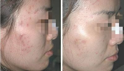 -SKINIST丽铂医疗美容