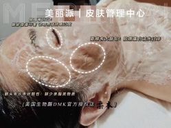 -MLP美丽派·问题肌疗愈中心