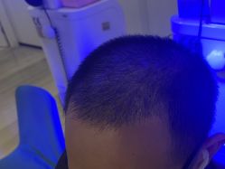 -雍禾植发全国连锁