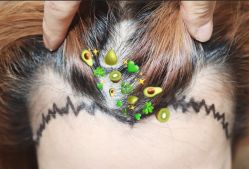 -大麦微针植发全国连锁