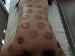 -益友堂盲人推拿正骨穴位按摩工作室